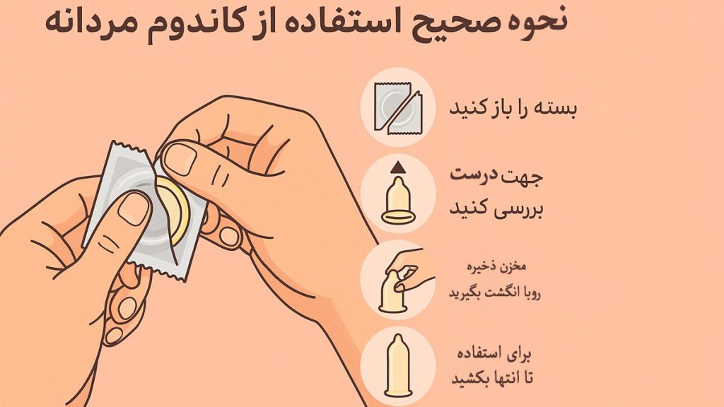 جلوگیری طبیعی+ کاندوم تاخیری + بهترین نوع کاندوم