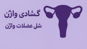 گشادی واژن + شلی عضلات واژن ( عوامل + درمان موثر) - تیبوکا